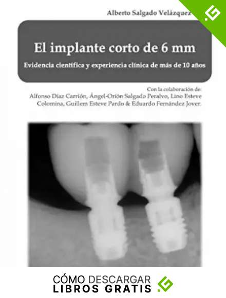 El implante corto de 6 mm: Evidencia cient&iacute;fica y experiencia de m&aacute;s de 10 a&ntilde;os.