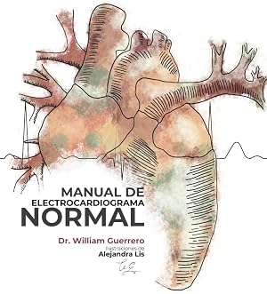 Manual de Electrocardiograma Normal
